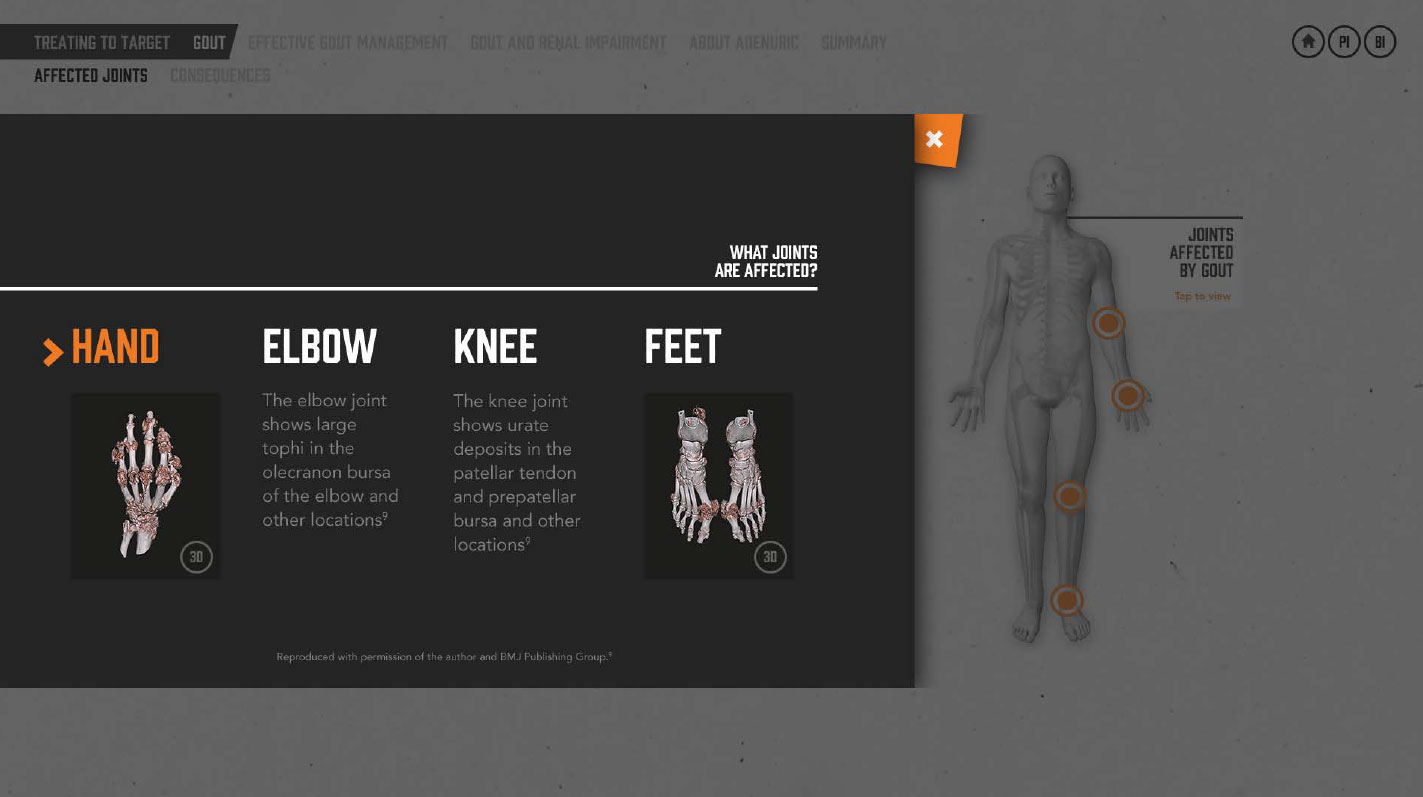 Flash eDetail Adenuric Modal